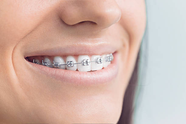 Best Traditional Braces  in Phillipsburg, NJ